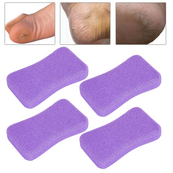 4 stk Callus Exfoliate Stone Fødpleje Pimpsten Fødder Hård Hud Fjern Pedicure Scrubber Lilla