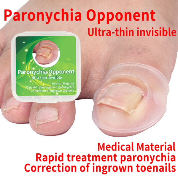 2st silikon inåtväxande tånagel korrigerande verktyg Smärtstillande Paronychia behandlingskorrigering