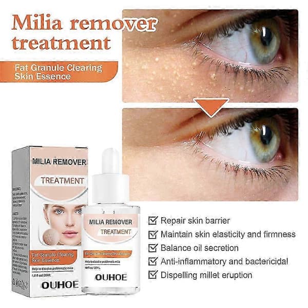 Miliafjerner - Opløs og reducer milia, hudorme, talgkirtelhyperplasi - 30 ml