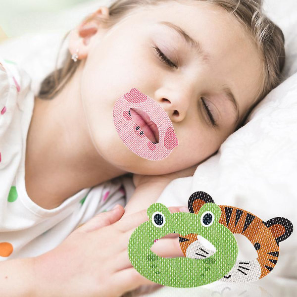 Børne tegneserieforseglingsklistermærker Ortopædiske åndedrætssøvnstrimler,mundtape til at sove,antisnoreplaster for mindre mundånde 30 stk. 30Pcs Frog