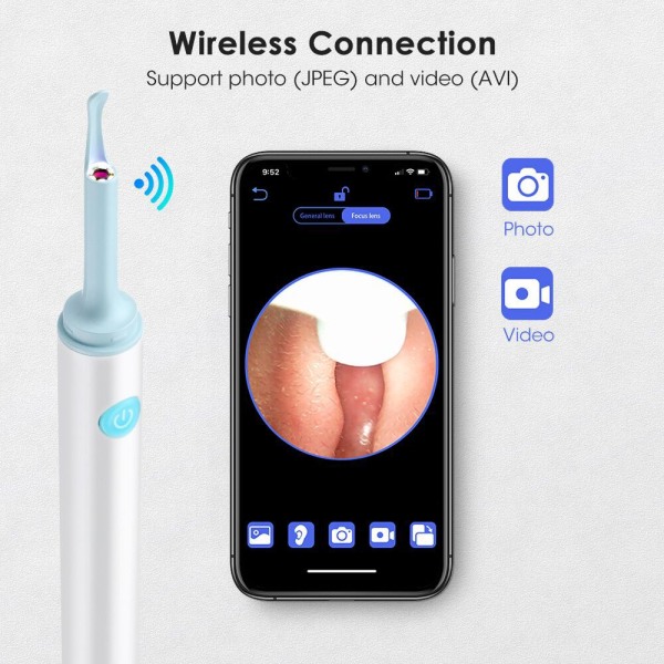 Smart Wireless Visual Ear Spoon - Visual Ear Cleaning Tool med bärbar trådlös design FA vit