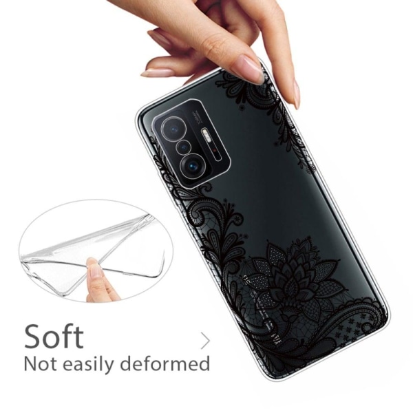 Marble Xiaomi 11T Suojakotelo - Lace Flower Black