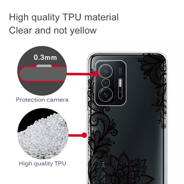 Marble Xiaomi 11T Etui - Lace Blomst Black