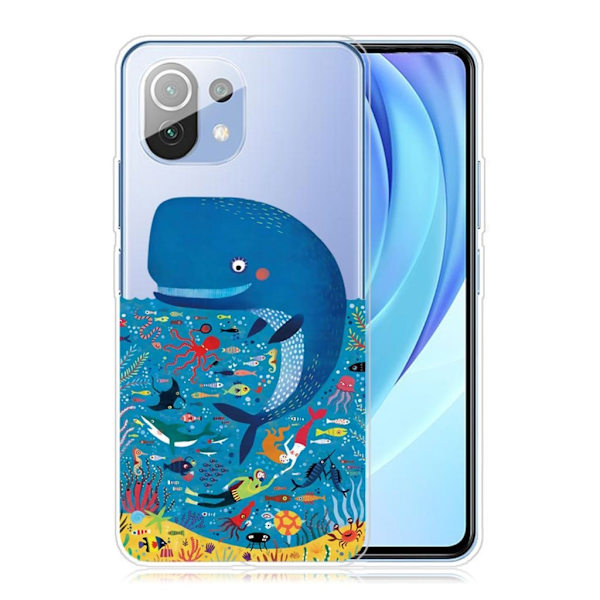 Deco Xiaomi Mi 11 Pro Etui - Hval Blue