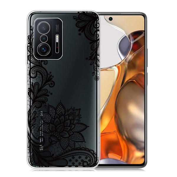 Marble Xiaomi 11T Etui - Lace Blomst Black
