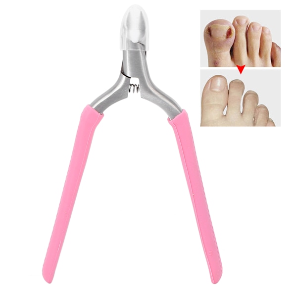 Nagelknipsare i rostfritt stål, tånagelklippare, verktyg för pedikyr och borttagning av förhårdnader, hållbar och skarp för säker och enkel nagelvård