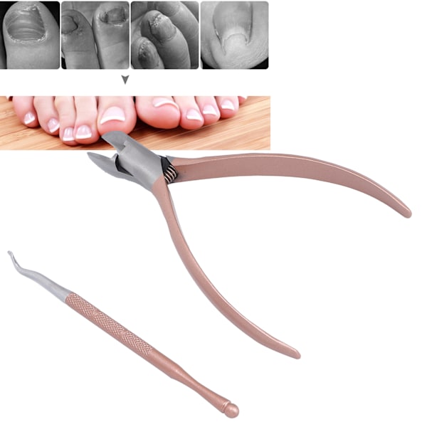 Rostfritt Stål Nagelklippare Roséguld & Nagellyftare för Inväxt Naglar Relief Pedikyr Verktyg Set, Professionell Nagelsvård