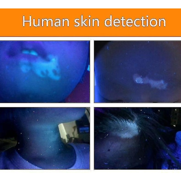Letvægts Håndholdt Woods Lampe Bølgelængde Ultraviolet Diagnostisk UV Hudsvamp Detektor Analysator + Lommelygte Funktion - yuhao