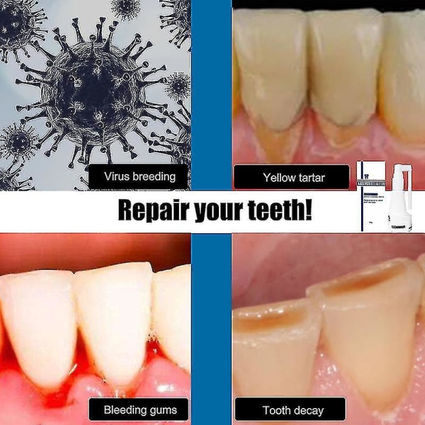 2kpl Hammaskiviä liuottava suihke hammaskivenpoistoaine Hampaiden puhdistusaine Suun suunhoito