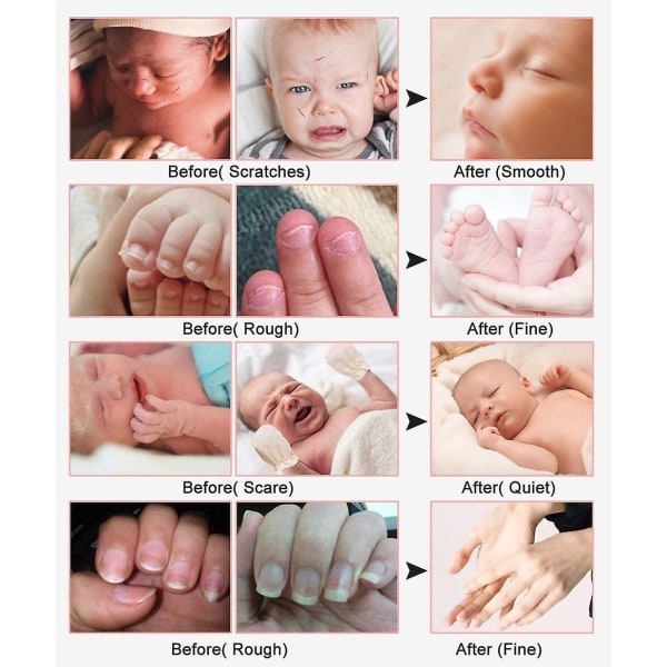 Elektrisk Baby Nagelfil, Nagelklippare för Bebis med Ljus, 10 Ersättningsdynor och 4 Hastighetsinställningar
