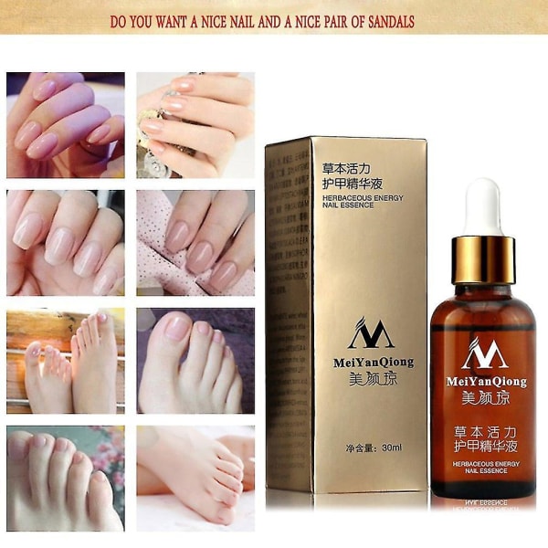 Meiyanqiong Nail Active Essence Grey Nail Remove 30ml