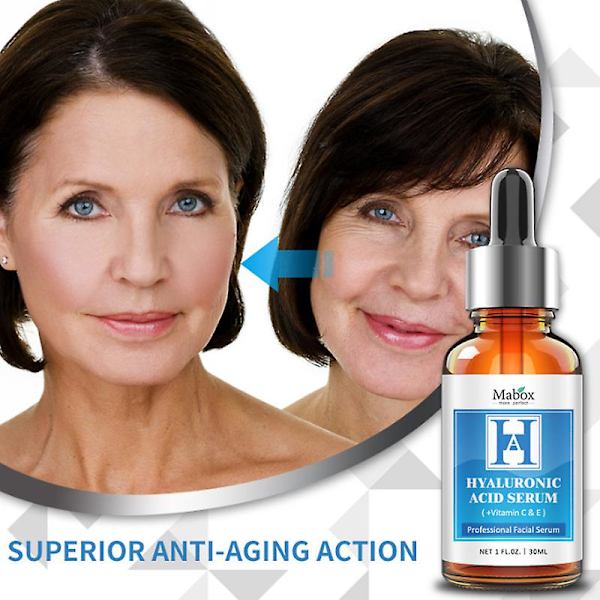Mabox Hyaluronsyre Essence 30ml