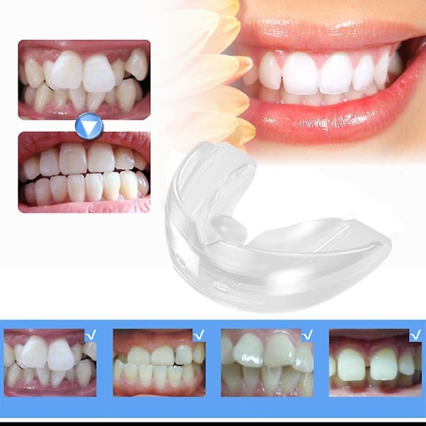 Hampaiden hampaiden ortodonttinen laitekoulutuslaite Alignment Adult