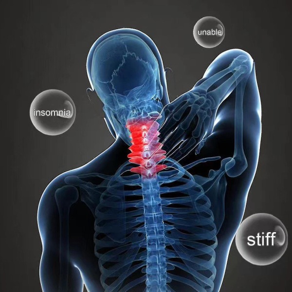 Minneskum Pute Ergonomisk Ortopedisk Nakke Justerbar Ergonomisk Konturer Ortopedisk Seng Pute