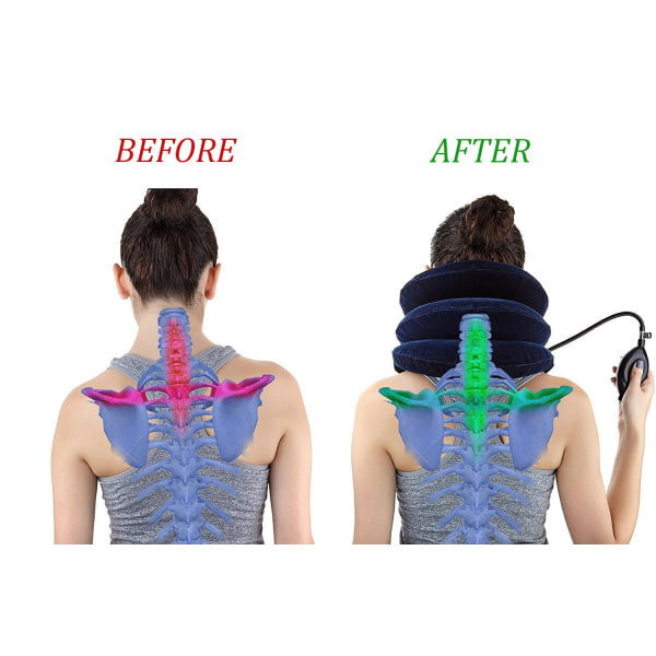 Traktionsanordning för halshals Uppblåsbar nackbår, lätt att använda för kronisk nacke- och axelsmärtalindrande dragkraftsinriktning (blå)