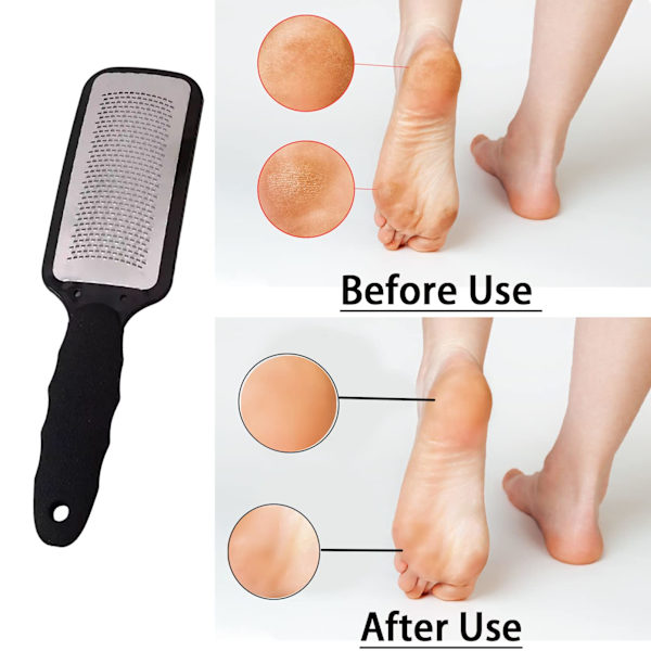 Hard Skin Remover Fotfiler, Rustfritt Stål Fot Callus Remover Fot Rasp for Død Hard Tøff Hud, Pedikyr, Profesjonell Salong Hjemmebruk (Svart)