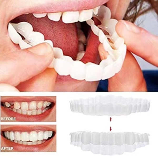 Seler Snap On øvre falske tænder Dental Finer Protes Cover