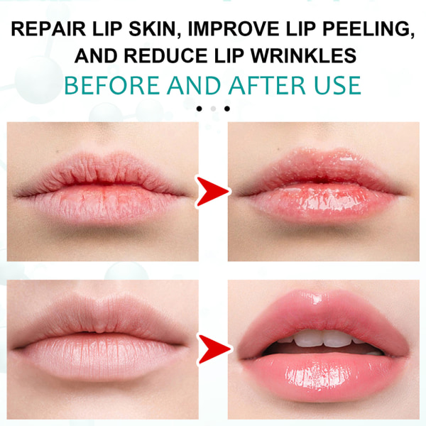 Anti-cracking Lip Care Liquid Reduce Dead Skin Care Läppförband 30ml