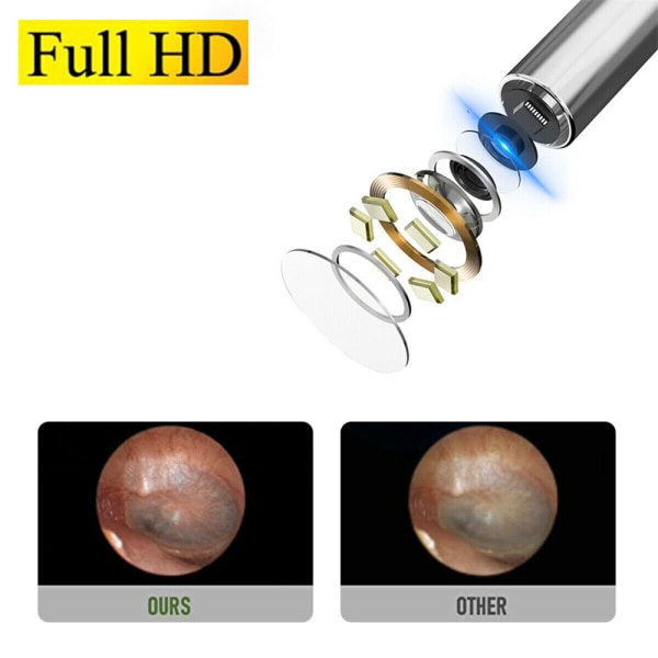 1080P trådlös öronvaxborttagningsverktyg för endoskopsked black