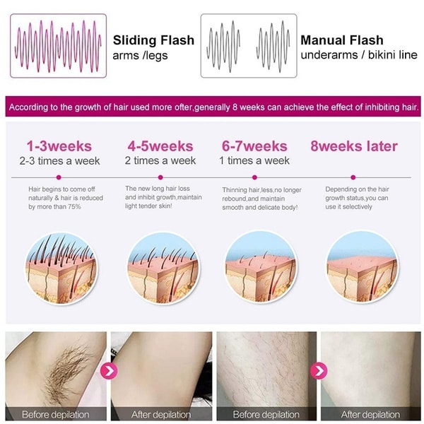 990 000 blink, 5 niveauer IPL Laser Hårfjerning Epilator