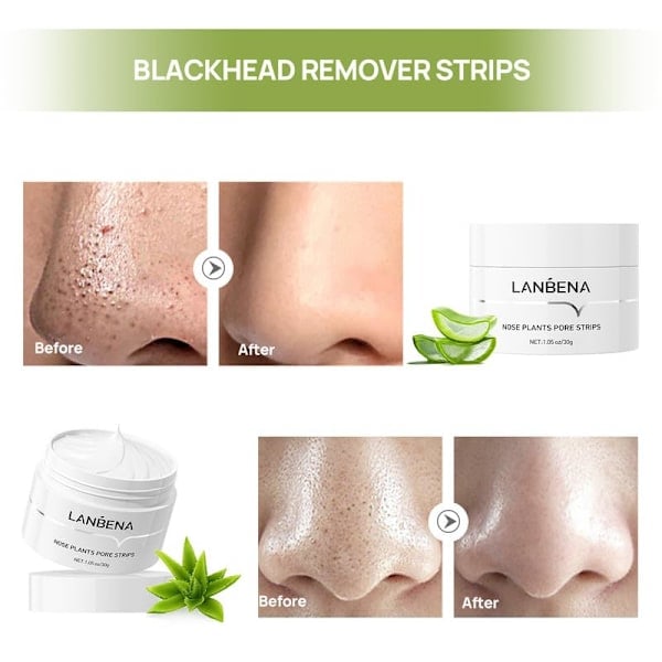 Nese Pore Strips - Fjern hudormer fra ansikt og nese, 30g