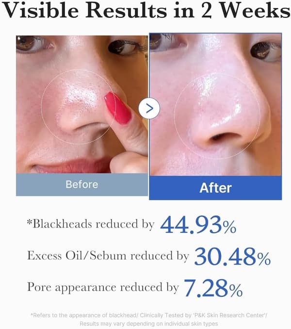 Poreless bomullsrondeller 2.0 (70 rondeller/155g)