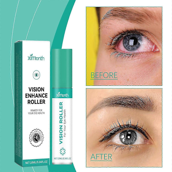 Vision Enhance Roller, Oftalminen Vision Enhance Roller, Vision Enhance Roller -silmähierontarulla, Lievittää Kuivia ja Rasittuneita Silmiä 2 kpl