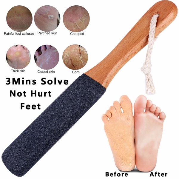 Fodfil Callus Remover Fodskrubber, Professionel Pedicure Fodrasp Fjerner Revnede Hæle, Død Hud, Hård Hud