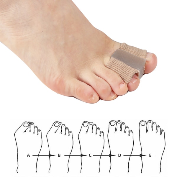 Knivtåseparatorer för överlappande tår Kvinnor Män, Geltåmellanlägg Knivkorrektor med 2 öglor för fötter (10 st stor storlek)
