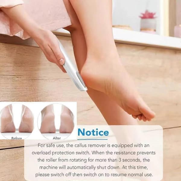 Electric Foot Callus Remover, Electronic Tool File, Professional Pedicure Kit Red Red