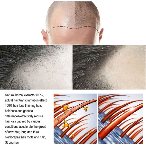 Qian Jaysuing Hårvård Flytande Starkt hår för att förhindra hårrotsmassage Närande vätska Tjock hårbotten 120ml