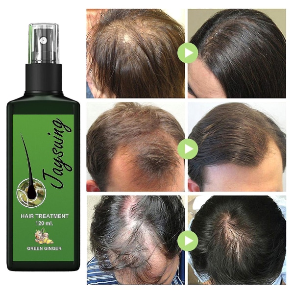Qian Jaysuing Hårvård Flytande Starkt hår för att förhindra hårrotsmassage Närande vätska Tjock hårbotten 30 ml