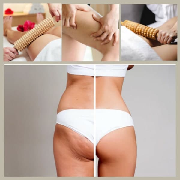 Træmassage Rulle Lymfemassage Sundhed Cellulite