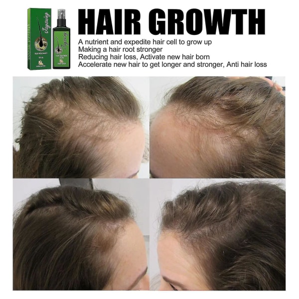 Qian Jaysuing Hårpleie Flytende Sterkt hår for å forhindre hårrotmassasje Nærende væske Tykk hodebunn120ml