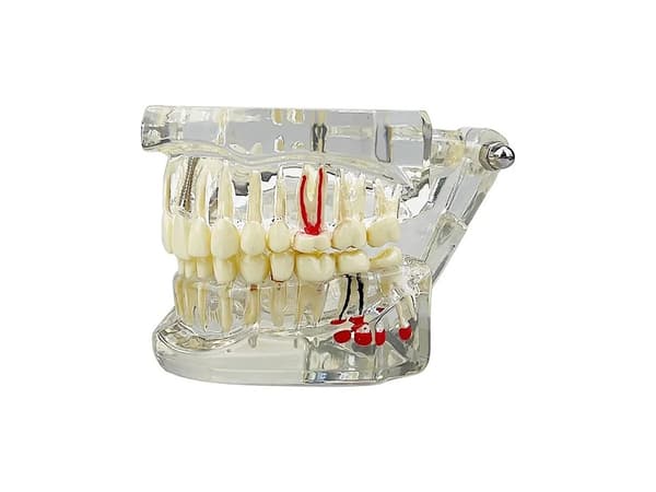 Anatomisk tandmodell - Protes