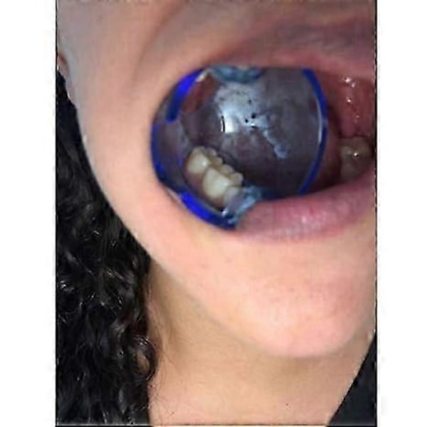 Dental Ortodontisk Läpp-Kindretraktor Expander Munöppnare Autoklaverbar för Bakre Tänder (15 stycken/lot)