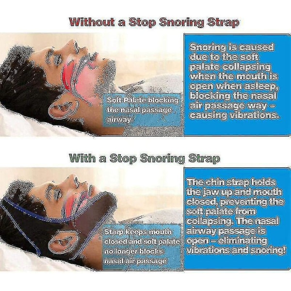 Effektiv anti-snorking - Ingen søvnapnémasker, anti-snorking hakerem, stopp snorking løsning hakerem, stopp snorking for menn kvinner, anti-snorking devi