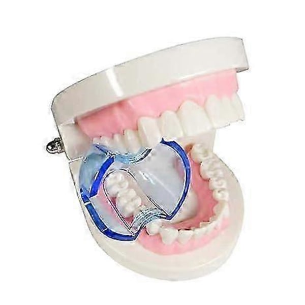 Dental Ortodontisk Läpp-Kindretraktor Expander Munöppnare Autoklaverbar för Bakre Tänder (15 stycken/lot)