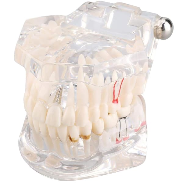 Anatomisk tandmodell - Protes