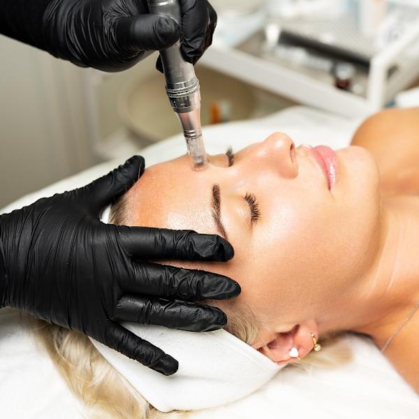 MicroneedlingPen för anti-age Vit