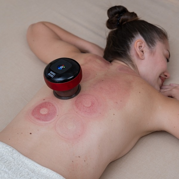 Cupping elektrisk - 12 nivåer one size