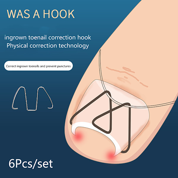 3 par främre spikkrok/gummiband Nail Art Inåtväxt tåspik C