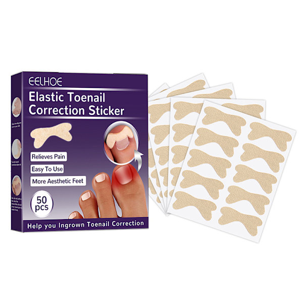 50 kpl sisäänkasvaneiden varpaiden kynsien korjaustarra Nail Strip Corrector St