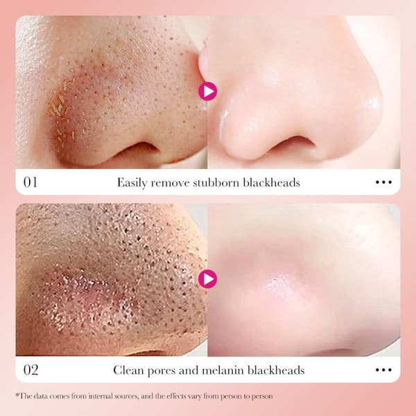 SADOER 6 STK Kul Dybtrensende Pore Strips Fjerner Hudorme