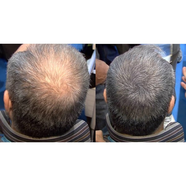 TEST HÅRFIBER - JASON BY SWEDEN - 4G - MELLANBLOND- MEDIUM BLONDE