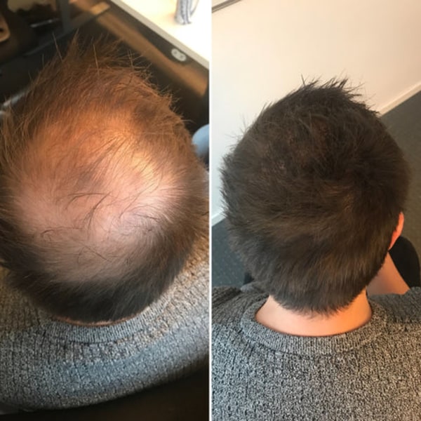Hårfiber - BUNEE Medium 12g - Auburn
