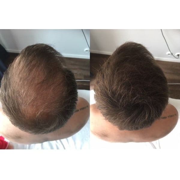 Prøve HÅRFIBER - JASON BY SWEDEN - 4G - GRÅ - GREY