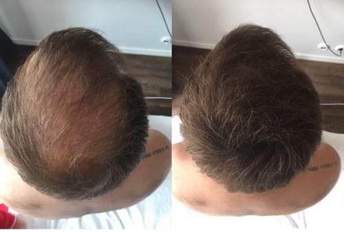 TEST HÅRFIBER - JASON BY SWEDEN - 4G - MELLANBRUN - MEDIUM BROWN