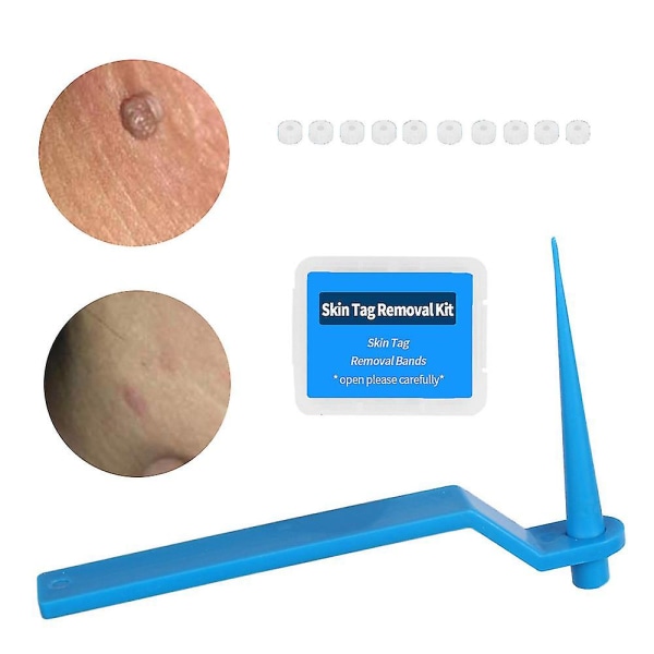 Skin Tag Remover Vårt Remover Skin Tag Removal Kit Skin Tag Mole Smärtfri Skin Tag Removal Set Skin Blue