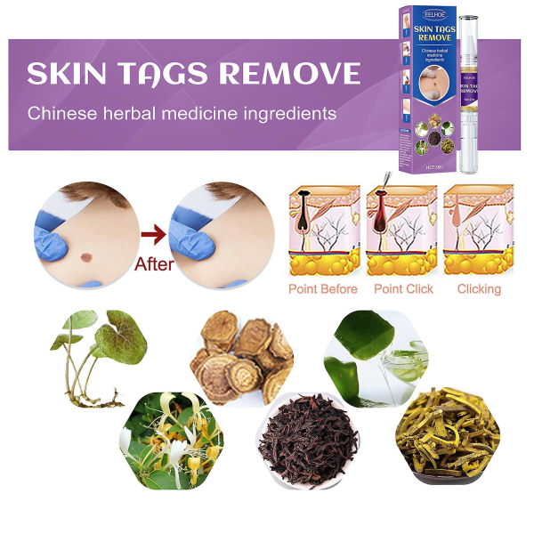 Skin Tag Remover Mycket effektiv och extra styrka Skin Tag And Mole Remover och Corrector 2PCS